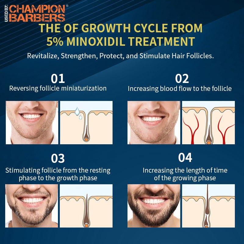 Champion Barbers Beard Growth Serum for Men 30ml- 5% Biotin Minoxidil Hair Growth Oil, 5% Minoxidil for Men and Women, Biotin Hair Growth Serum Minoxidil, Nourishes Scalp, Stops Hair Loss & Thinning Hair Care Repairing